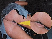Jodie Marsh Upskirt